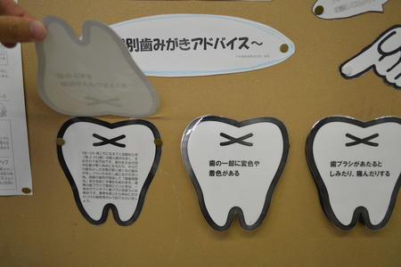 歯と口の.JPG