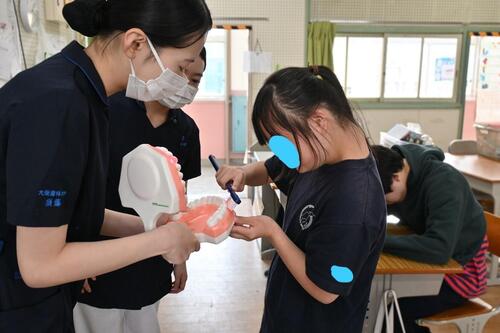 歯３.jpg